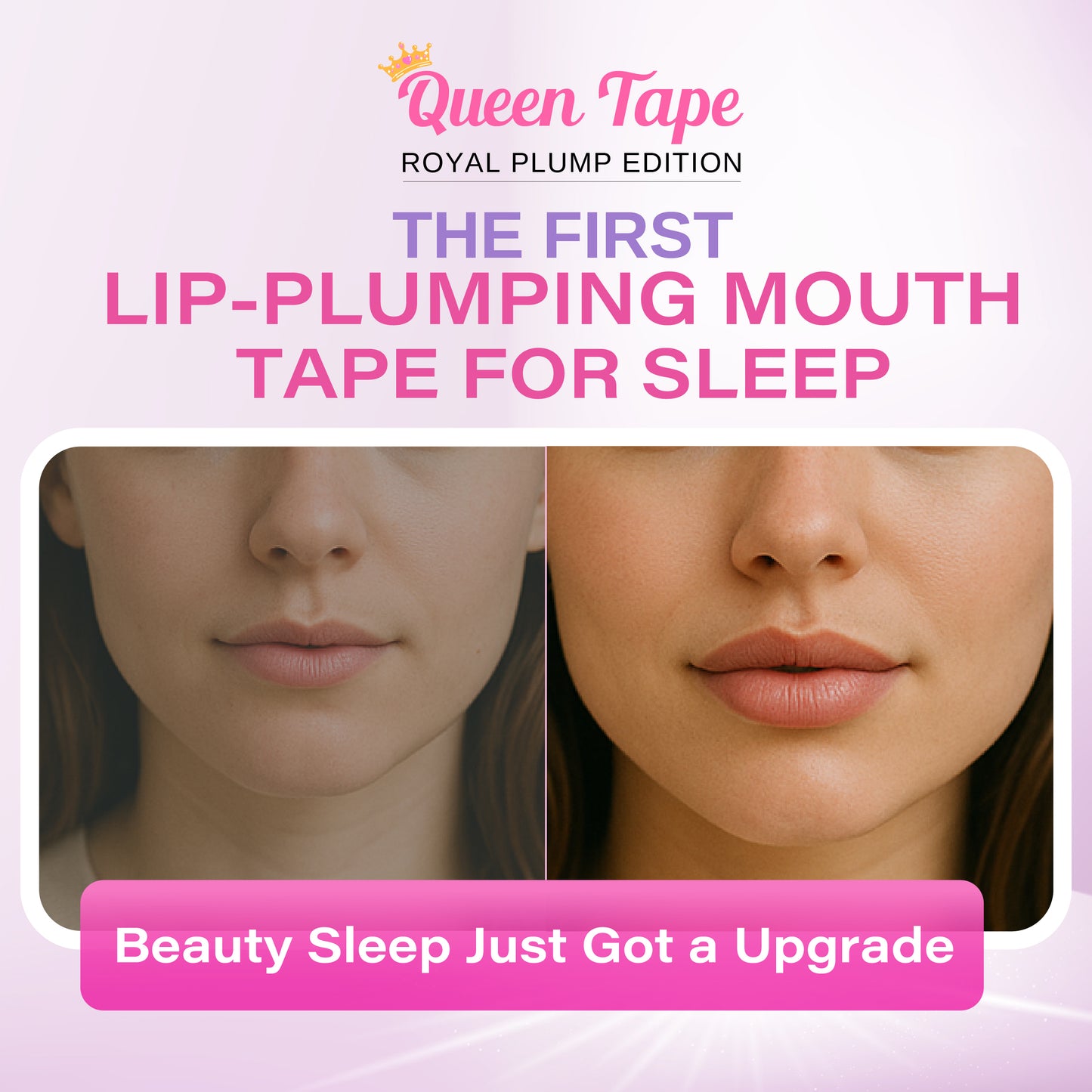 Queen Tape - Hydrating & Moisturizing Mouth Tape - Queen Tape